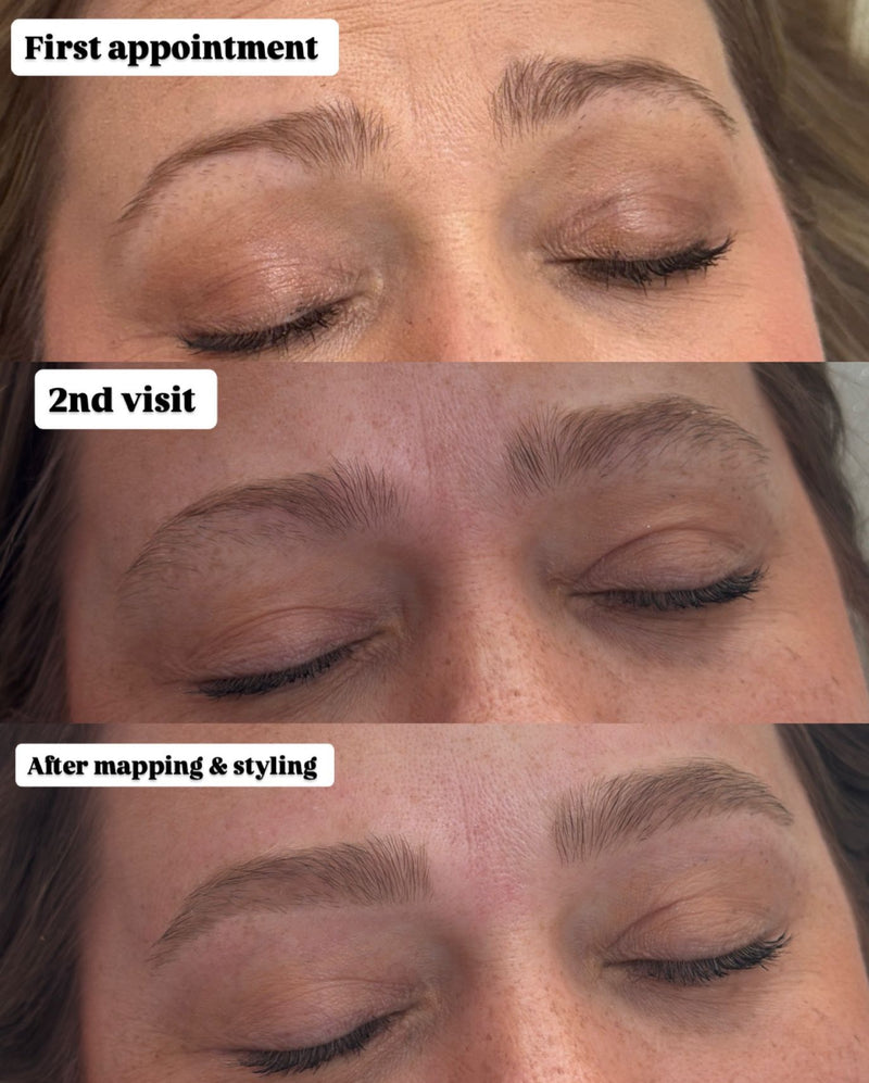 Brow Rehab