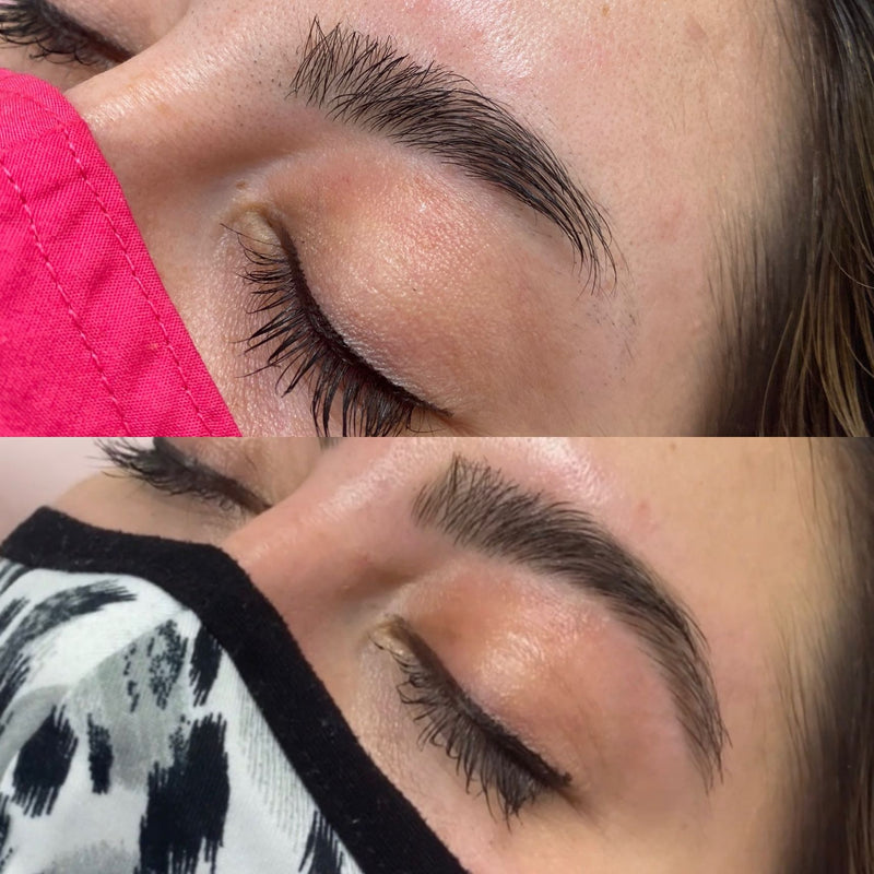 Eyebrow Rehab