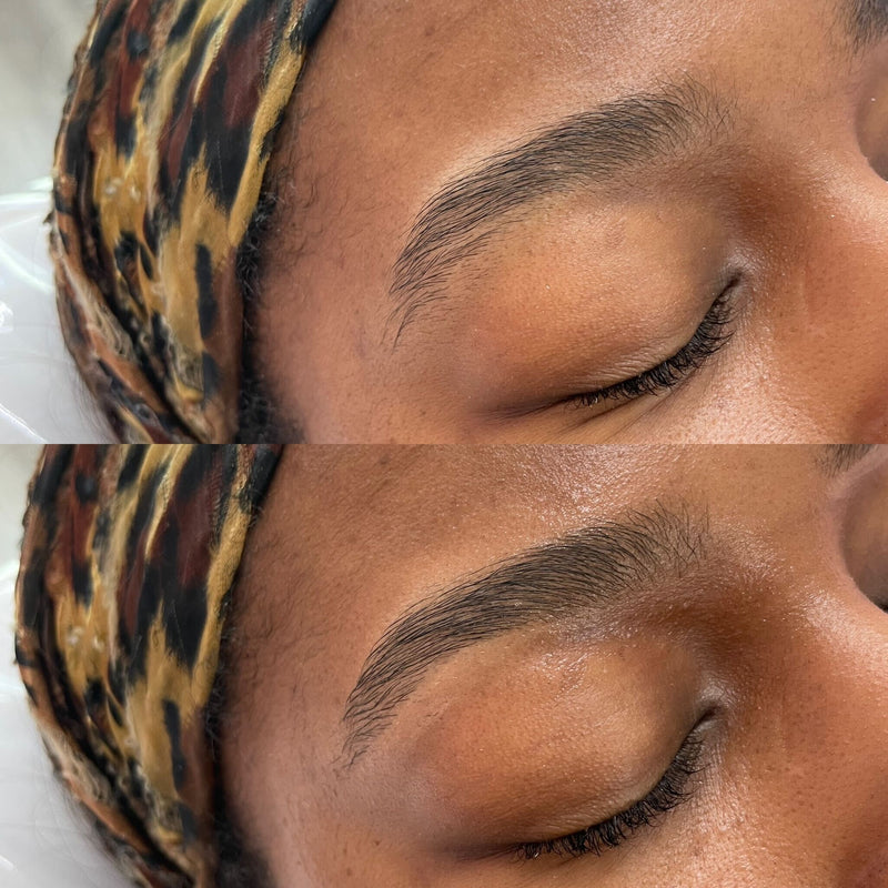 Brow Transformation